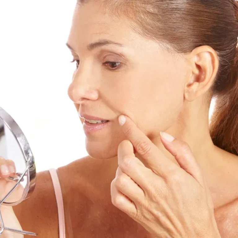 facial-co2-laser-resurfacing